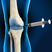 Intraarticluar Knee Injection